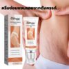 ครีมแตกลาย100% EELHOE ครีมท้องลาย ลดรอยแตกลาย สำหรับการซ่อมแซมผิวหลังคลอด รอยแตกลาย ร่องไขมัน ลดรอยแตกลาย